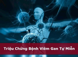 Triệu Chứng Bệnh Viêm Gan Tự Miễn - Xét Nghiệm Chuẩn Đoán Bệnh Gồm Những Gì